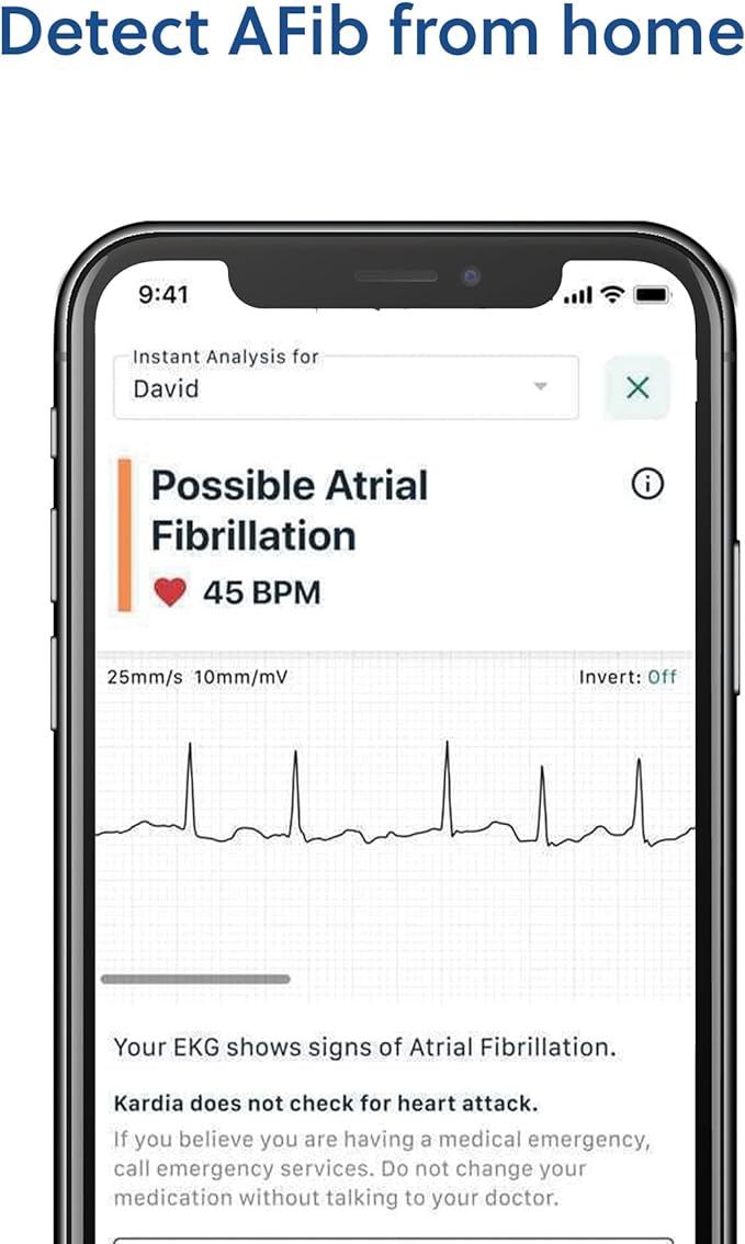 KardiaMobile 1-Lead Personal EKG Monitor – Record EKGs at Home – Detects AFib and Irregular Arrhythmias